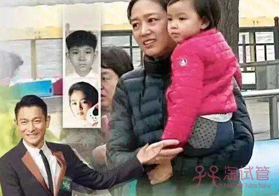 试管婴儿~注意这几点成功率翻倍！