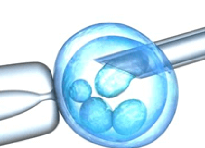 供精试管婴儿前必须做人工授精吗？