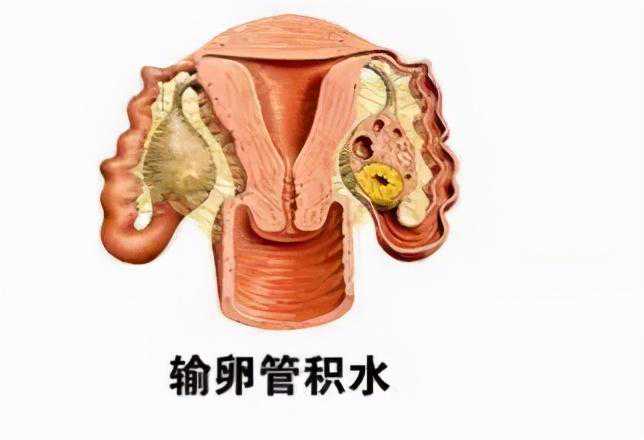 这三大疾病还能影响试管成功率！你知道吗？