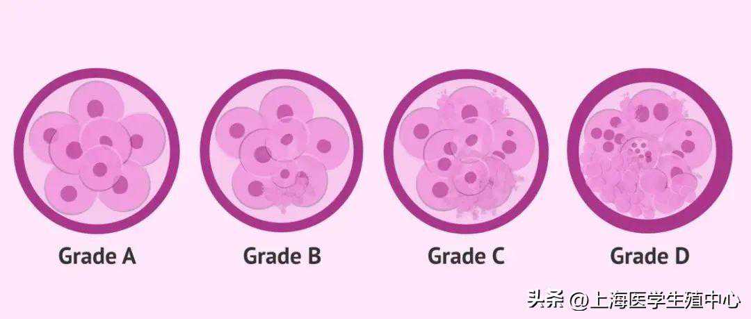 想让试管移植成功率翻倍？不妨试试这六招！