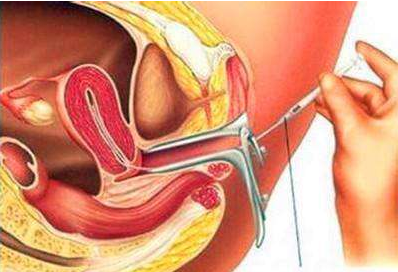 试管婴儿移植D3胚胎后的注意事项有哪些？