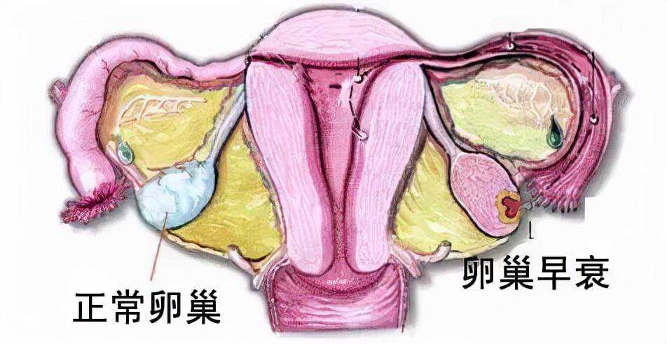 乐仁真相丨辟谣！别再让试管背锅这个“误区”