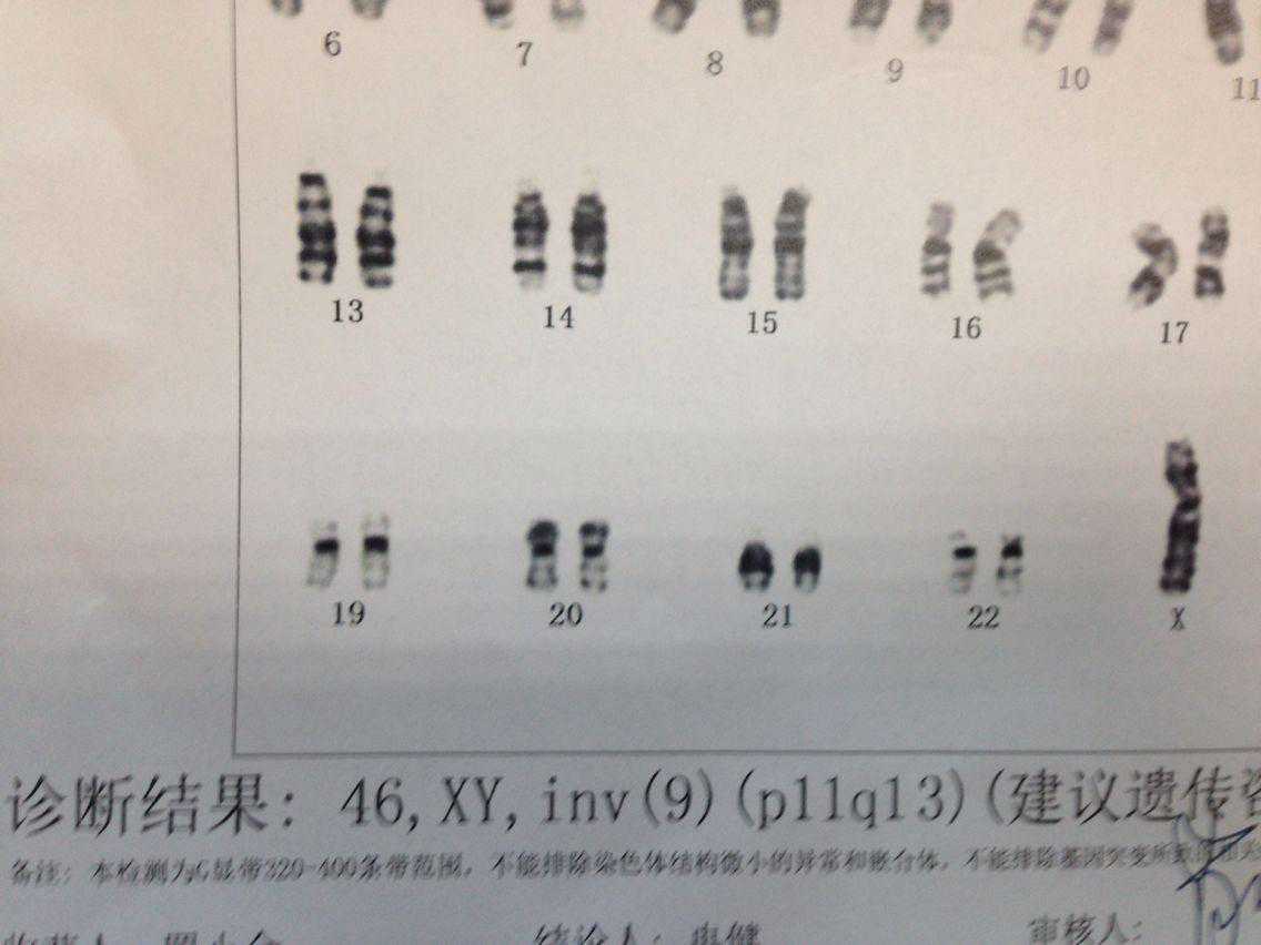 老公检查染色体 经历三次试管还是成功了