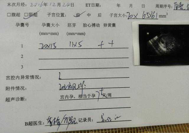 大龄多囊卵巢，备孕六年，人造试管都试了遍，结果意外自怀了