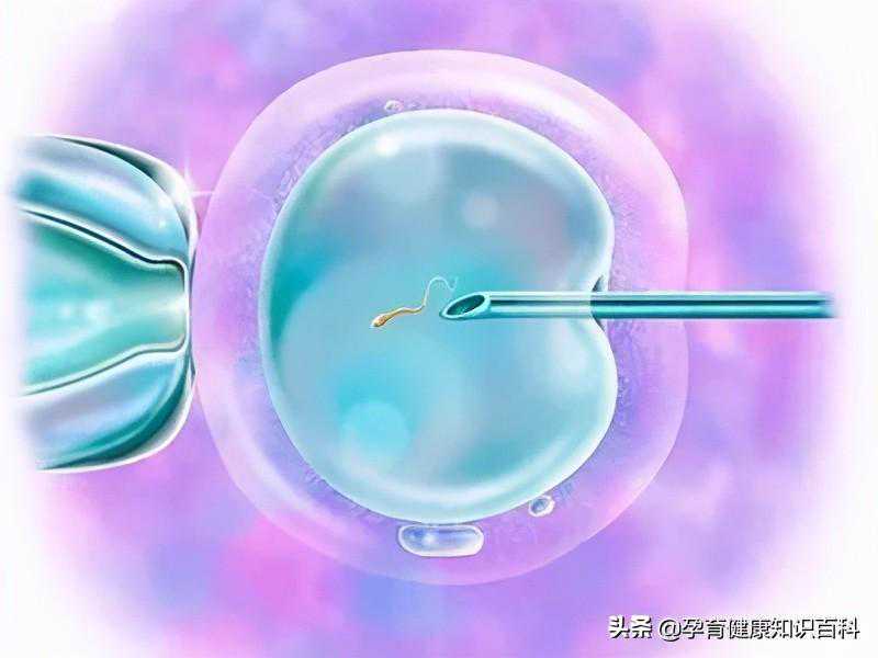 《辅助生殖技术》—试管婴儿反复移植失败怎么办？最全信息这里有