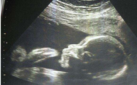 三次试管终于怀上了，听到消息她哭了，惊喜的同时松了一口气！