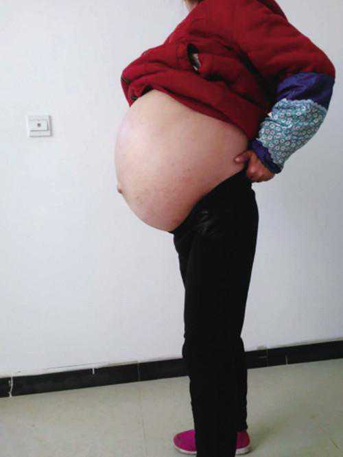 高龄产妇试管怀上双胞胎突然见红，婆婆的话让医生哭笑不得