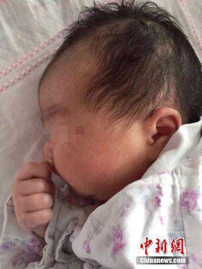 胚胎沉睡18年被唤醒 试管婴儿冷冻胚胎移植成活率高吗?