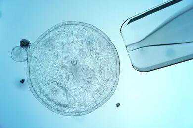 试管婴儿移植完就没事了？少了这个关键步骤，一切努力都会白费