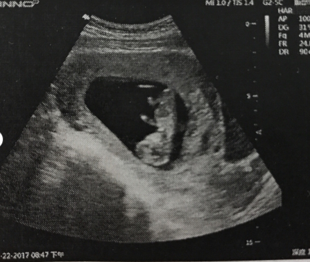 我的孕期记录！（备孕+产检+男宝秘诀）