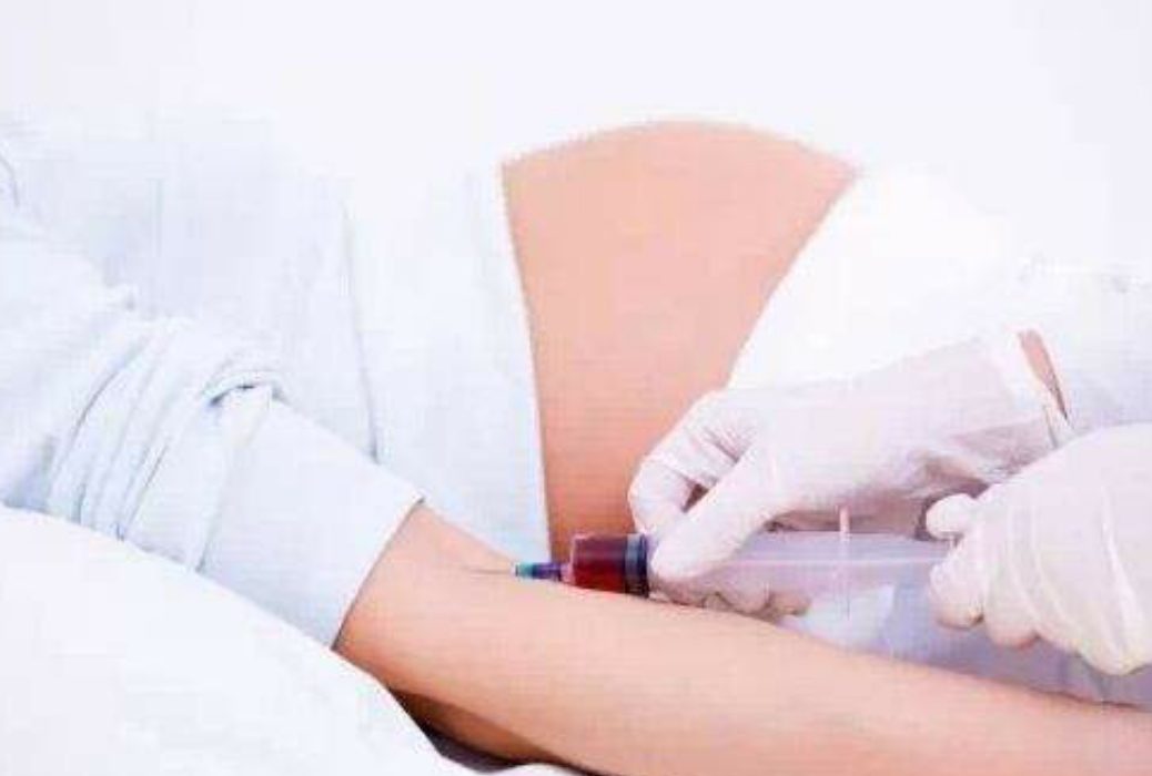 知道孕期需要抽血的检查项目吗？今天给孕妈们总结了，值得推荐！