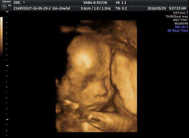 顺产男宝一枚，分享下孕期症状