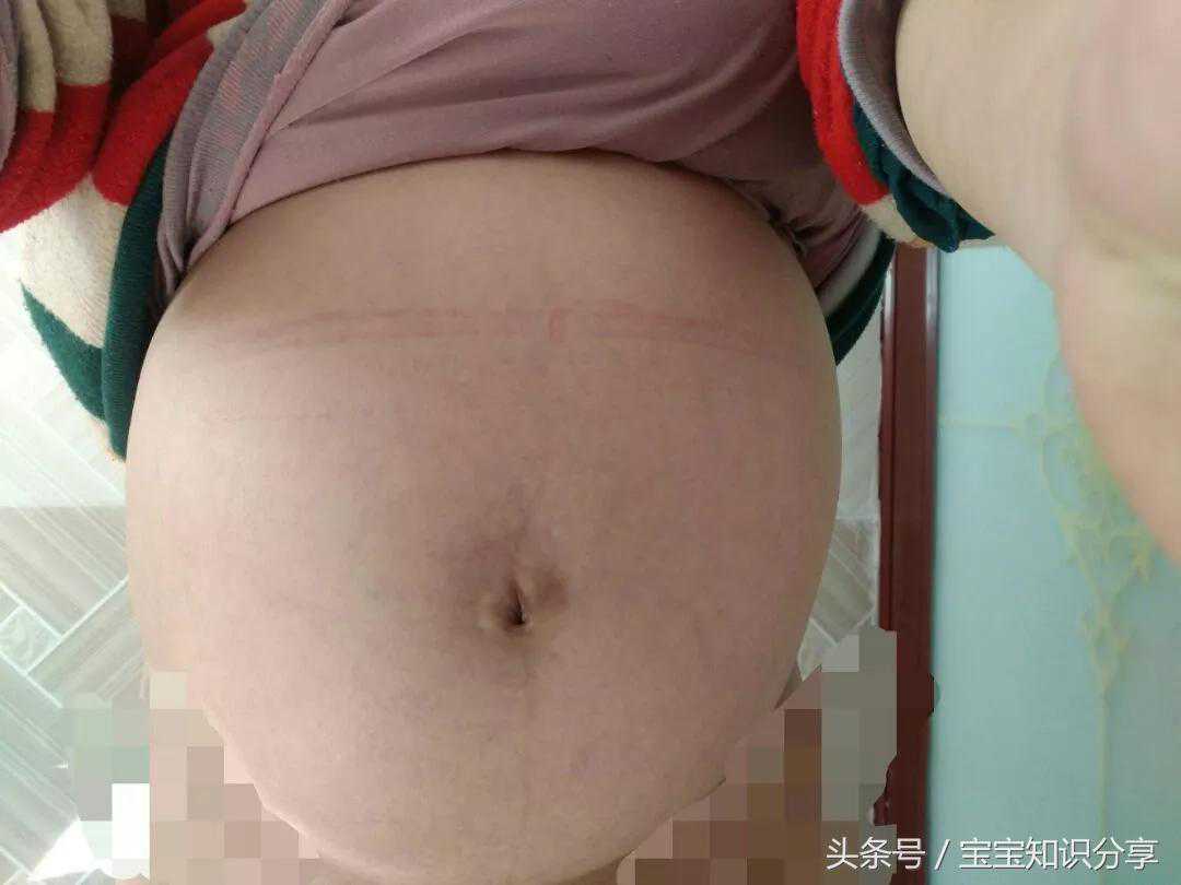 二胎性别测试男翻女 分享孕期症状 B超知男女 教你看会B超单