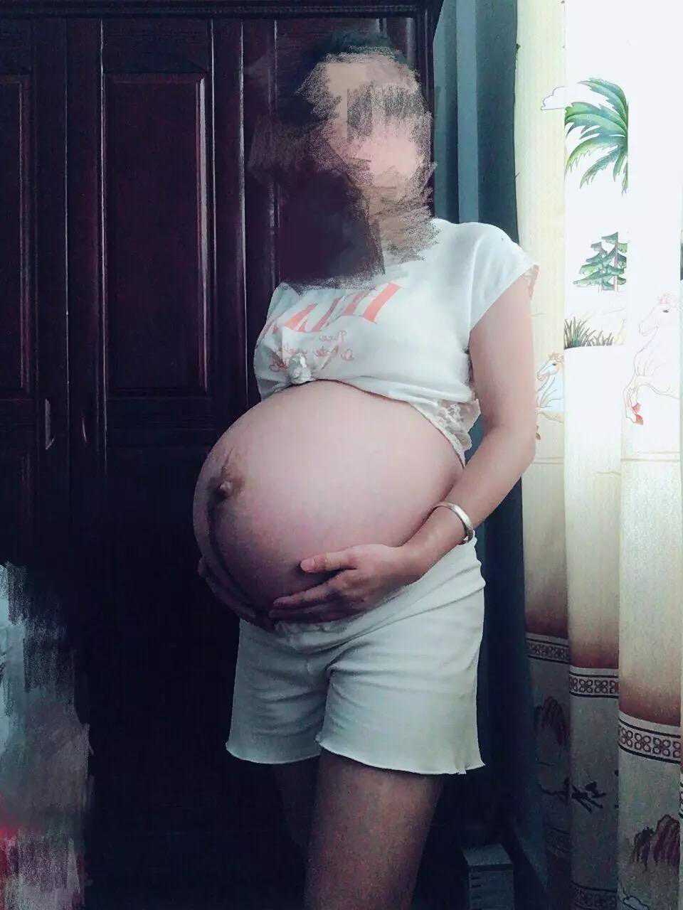 孕期不忌口，顺产不了，还好剖腹产是健康男宝