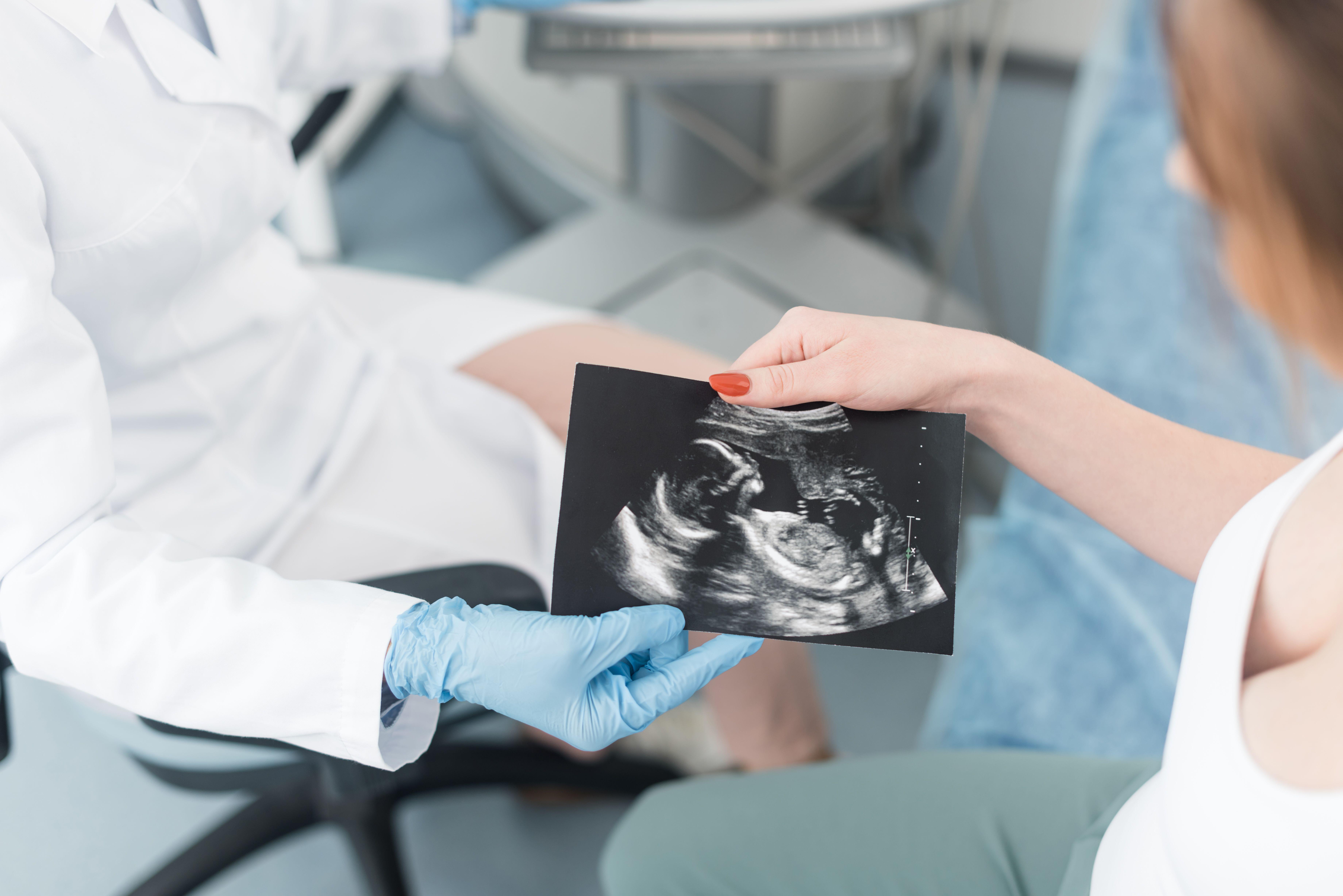 备孕需要做好哪些准备？生出健康聪明的宝宝