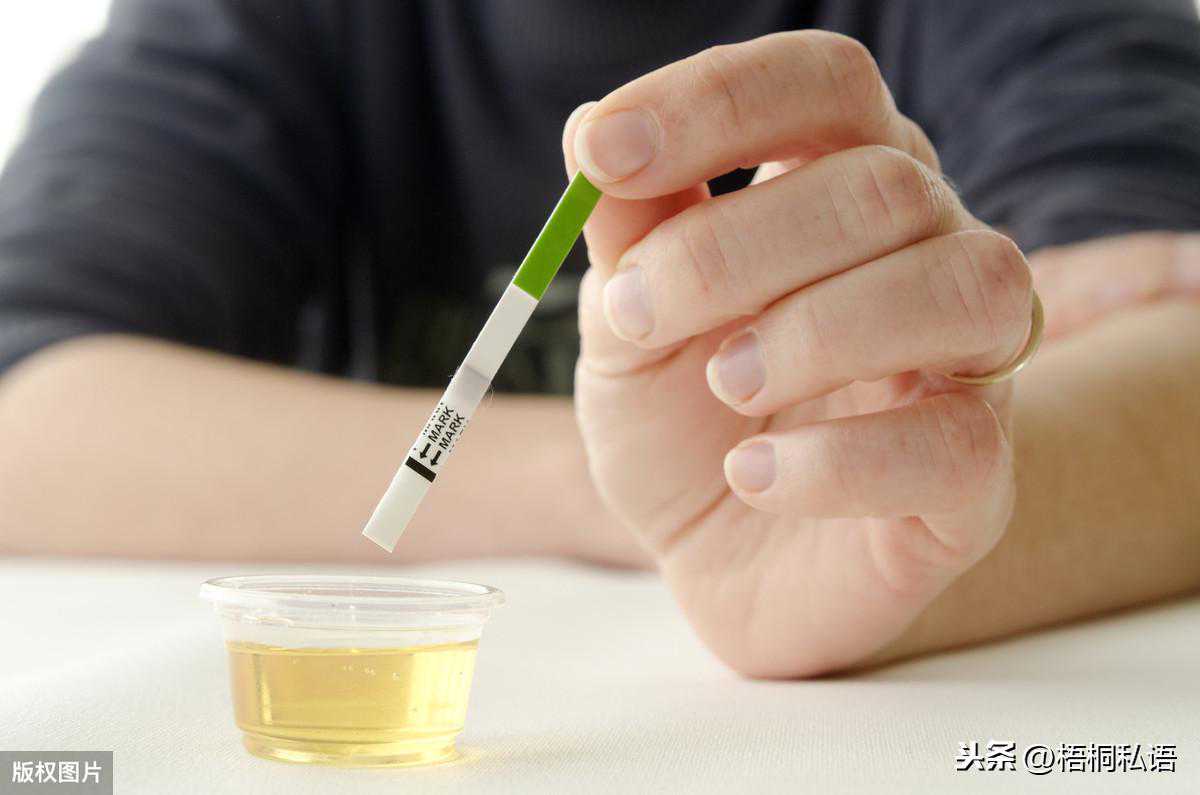 备孕小白攻略-排卵试纸如何使用？