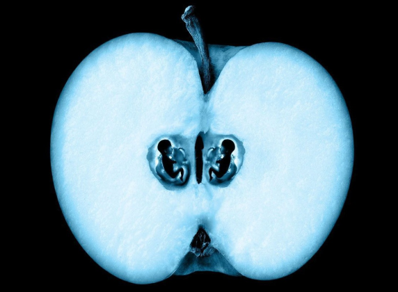 孕期B超怎么看胎儿性别和健康？