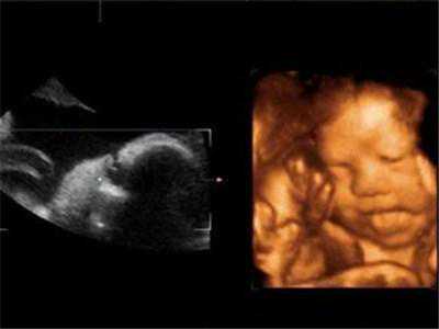 顺利产女归来，想要女宝的快来接哦！附孕期症状！